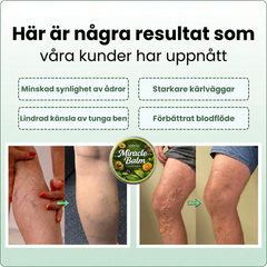 Sorvic Miracle Balm