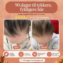 Slutt å se hår i avløpet innen 26 dager