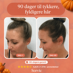 Slutt å se hår i avløpet innen 26 dager