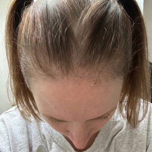 After - Ingvild, 45