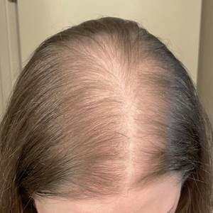 Before - Marianne, 41