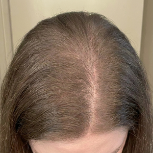 After - Marianne, 41