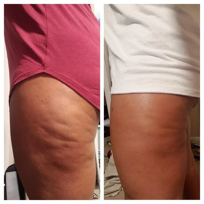Silk Anti-Cellulite Oil Med Kollagen