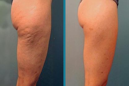 Silk Anti-Cellulite Oil Med Kollagen
